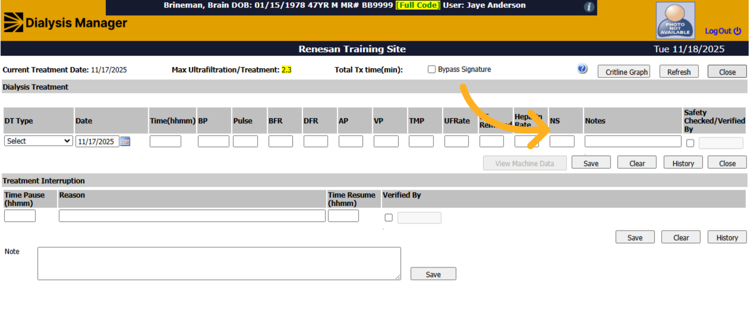 Close Dialysis Treatment Window
