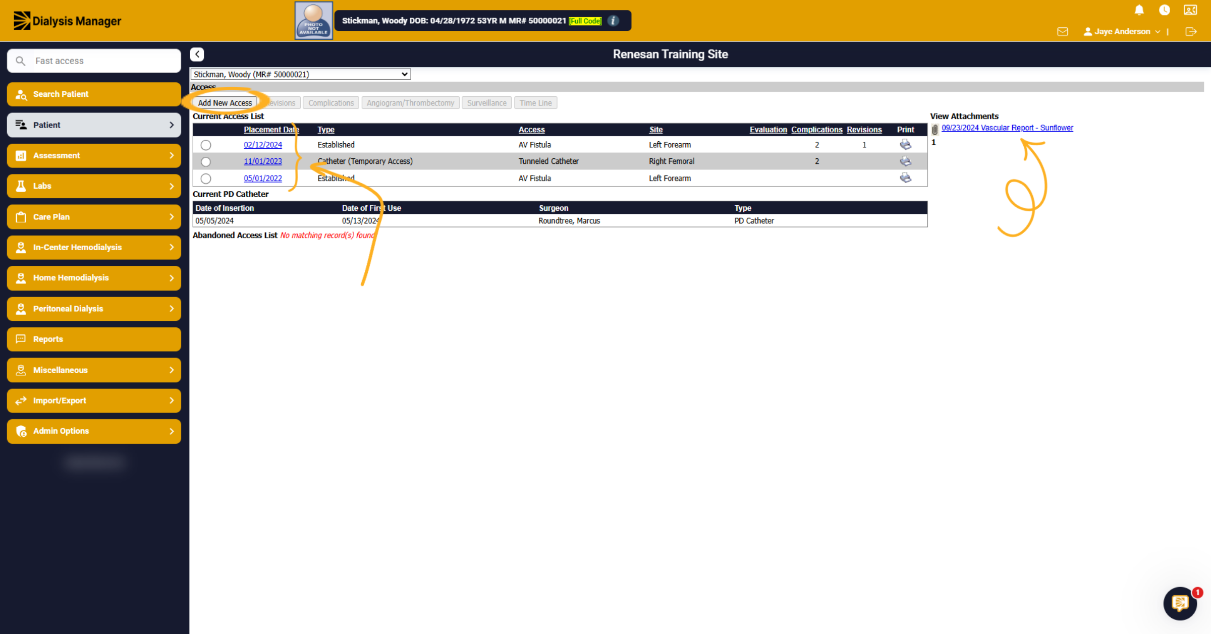 Select Date Entry