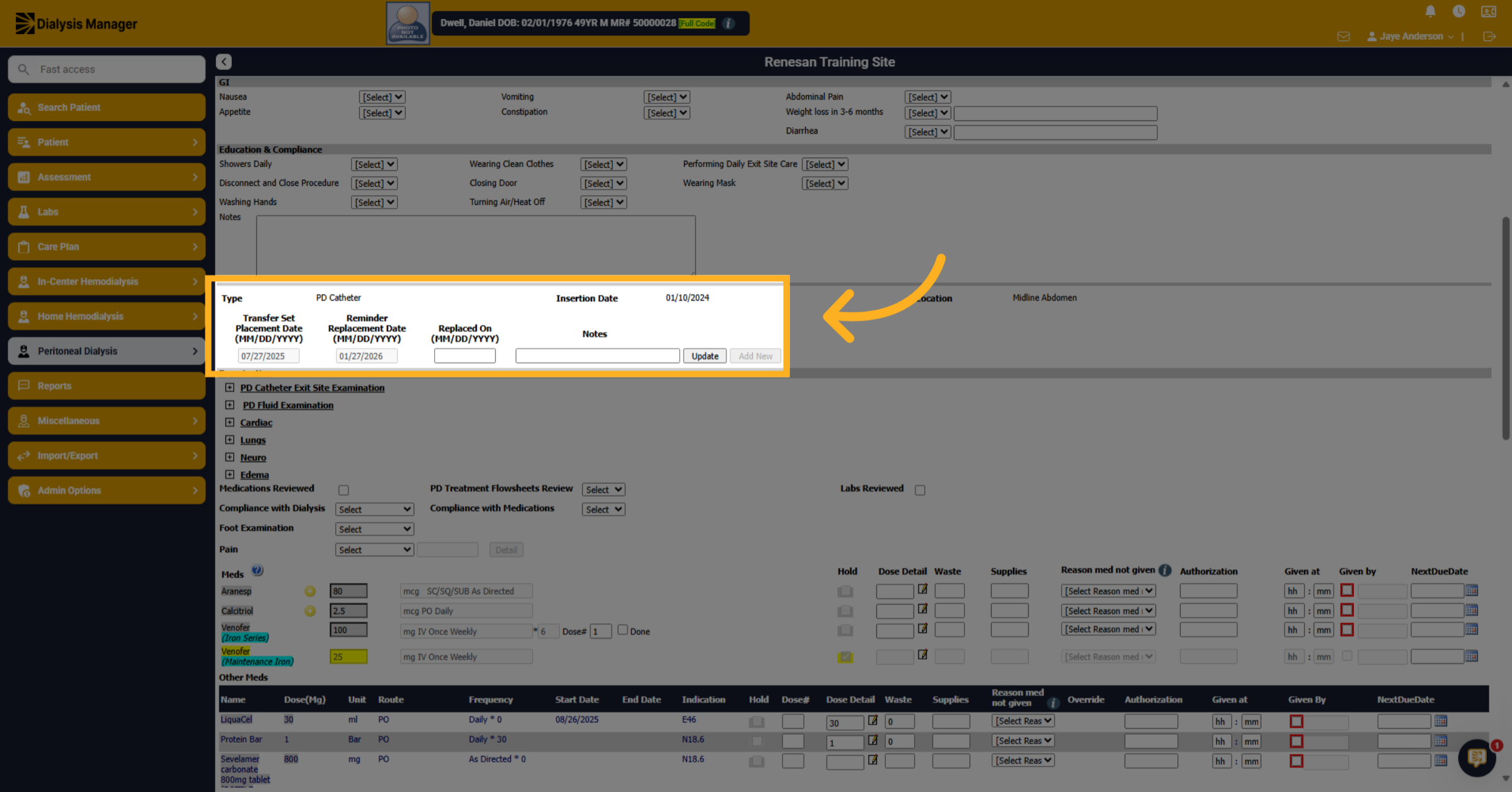 Access Transfer Set Placement Date