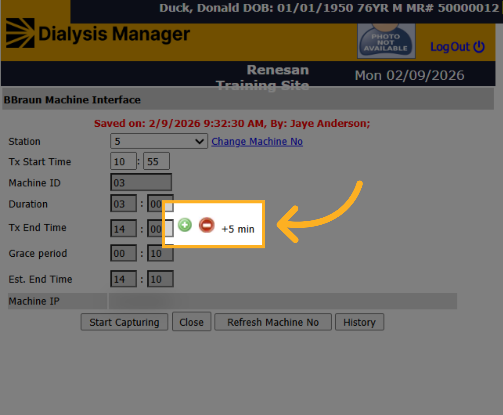 Adjust Duration