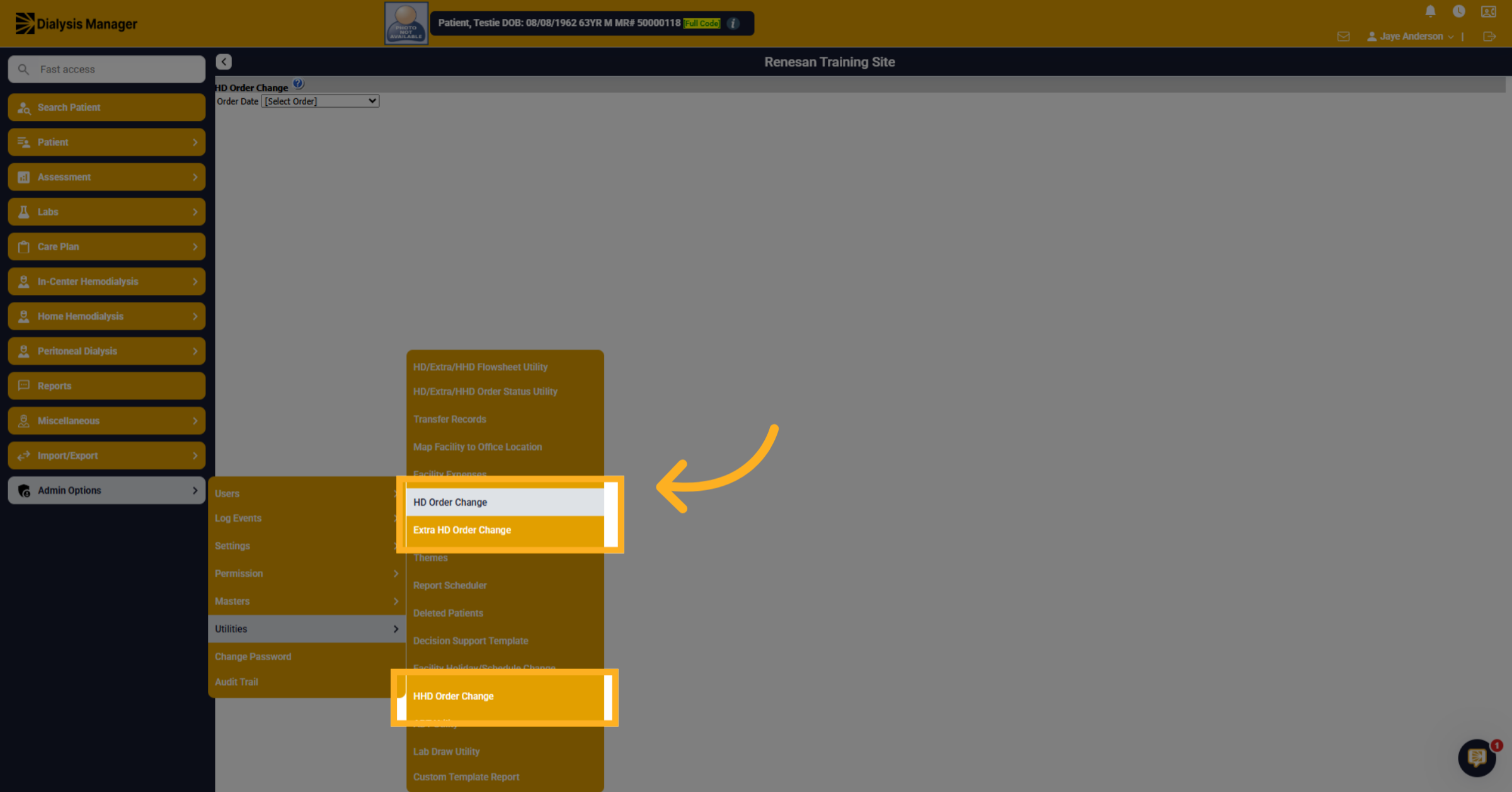 Select HD Order Change