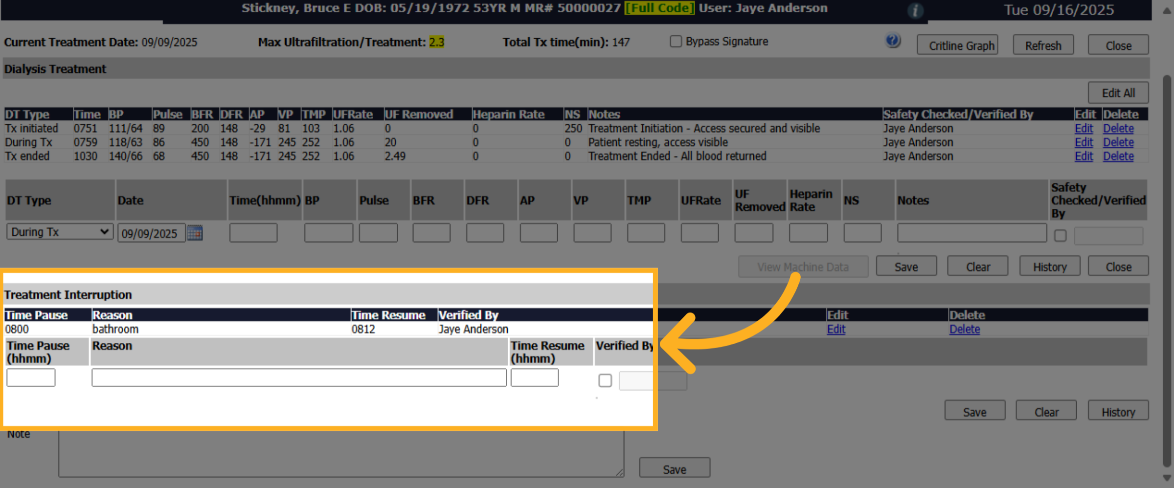 Click 'Treatment Interruption'