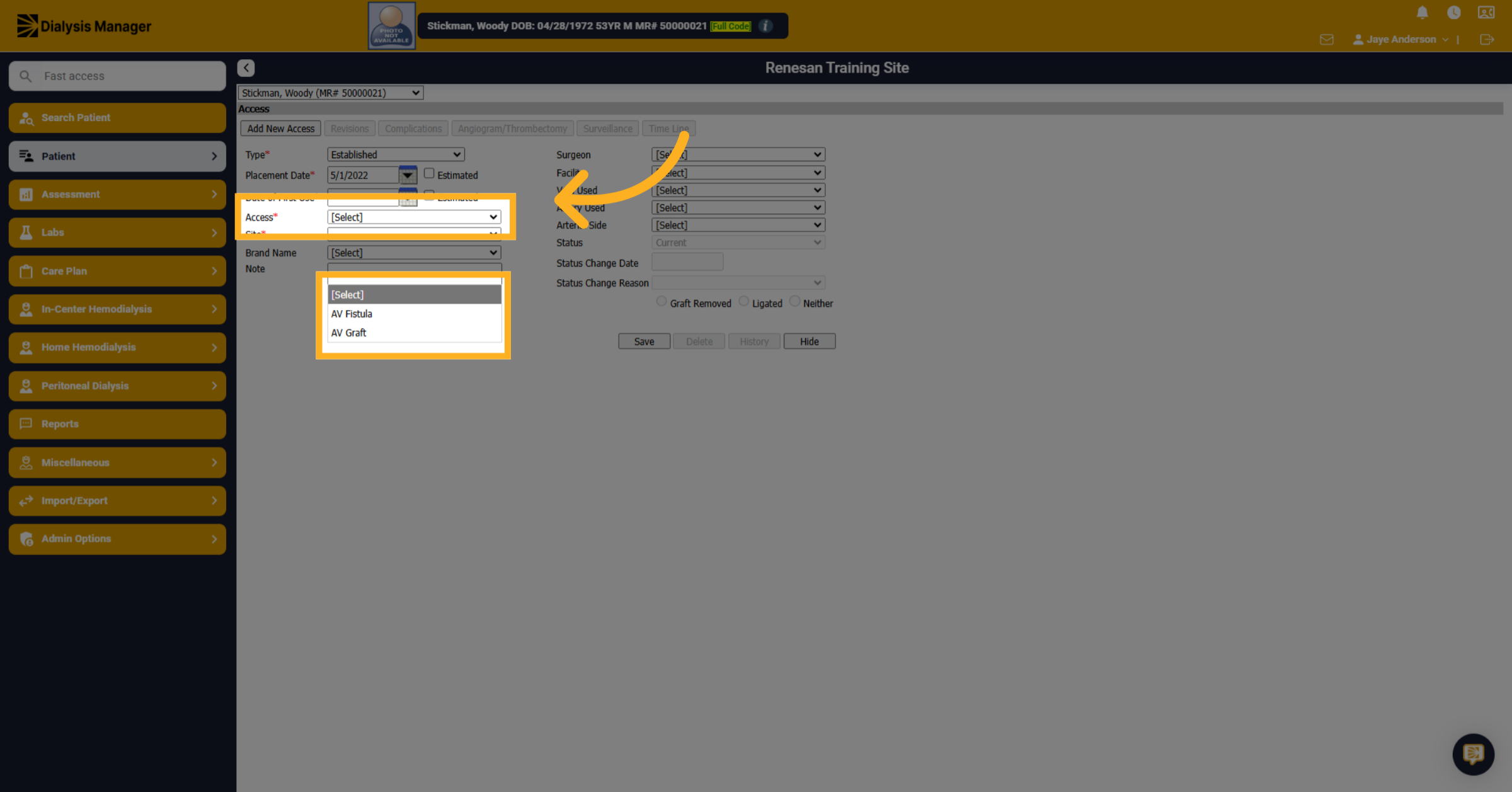 Click '[Select]AV FistulaAV Graft'