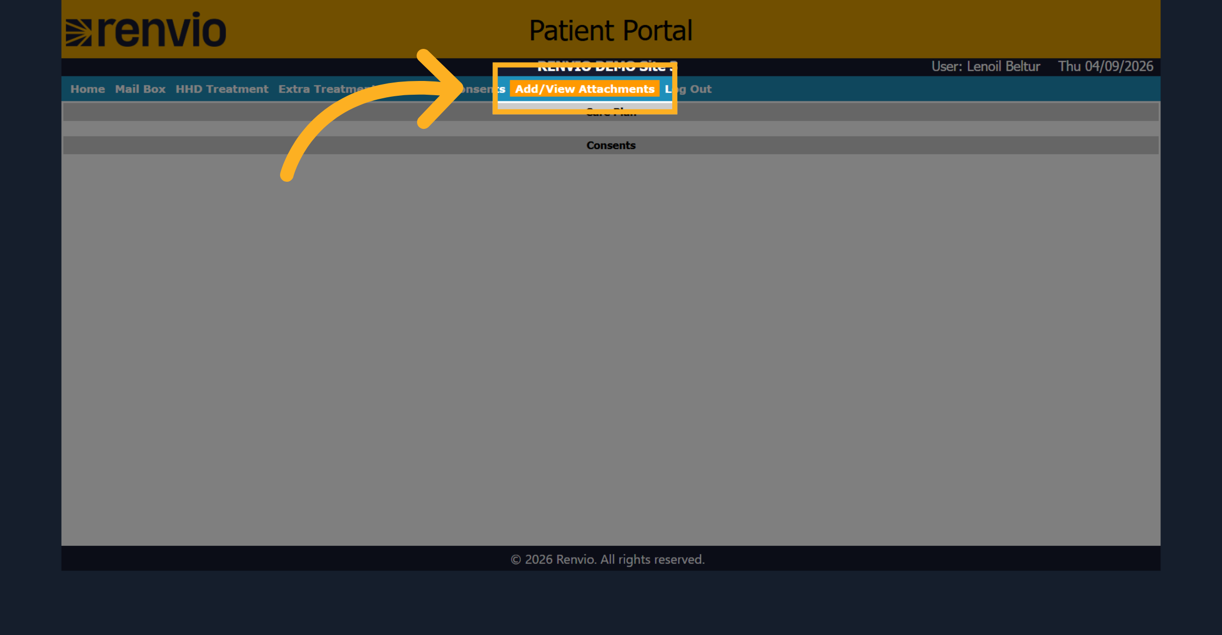 Manage Attachments