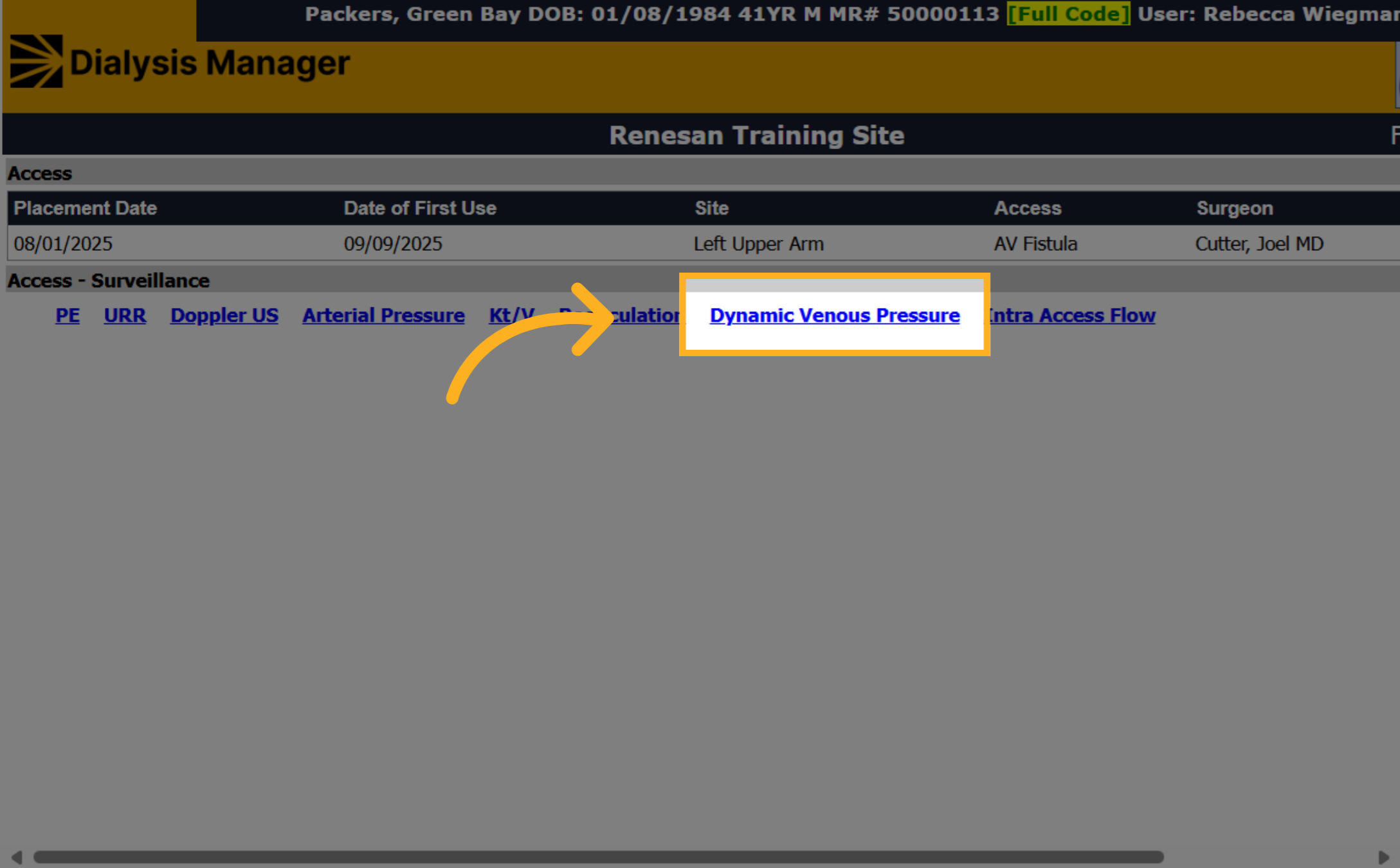 Click 'Dynamic Venous Pressure'