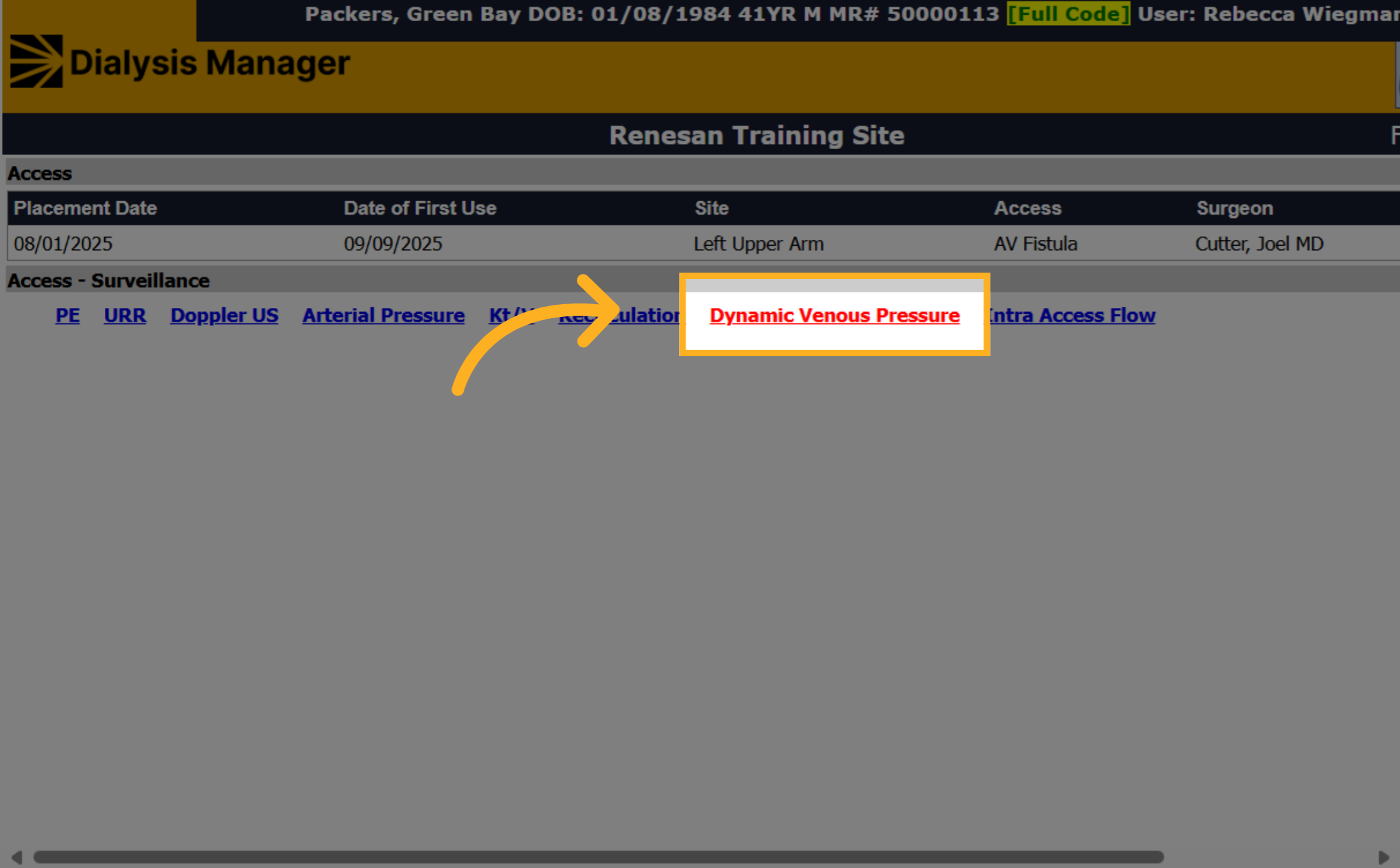 Click 'Dynamic Venous Pressure'