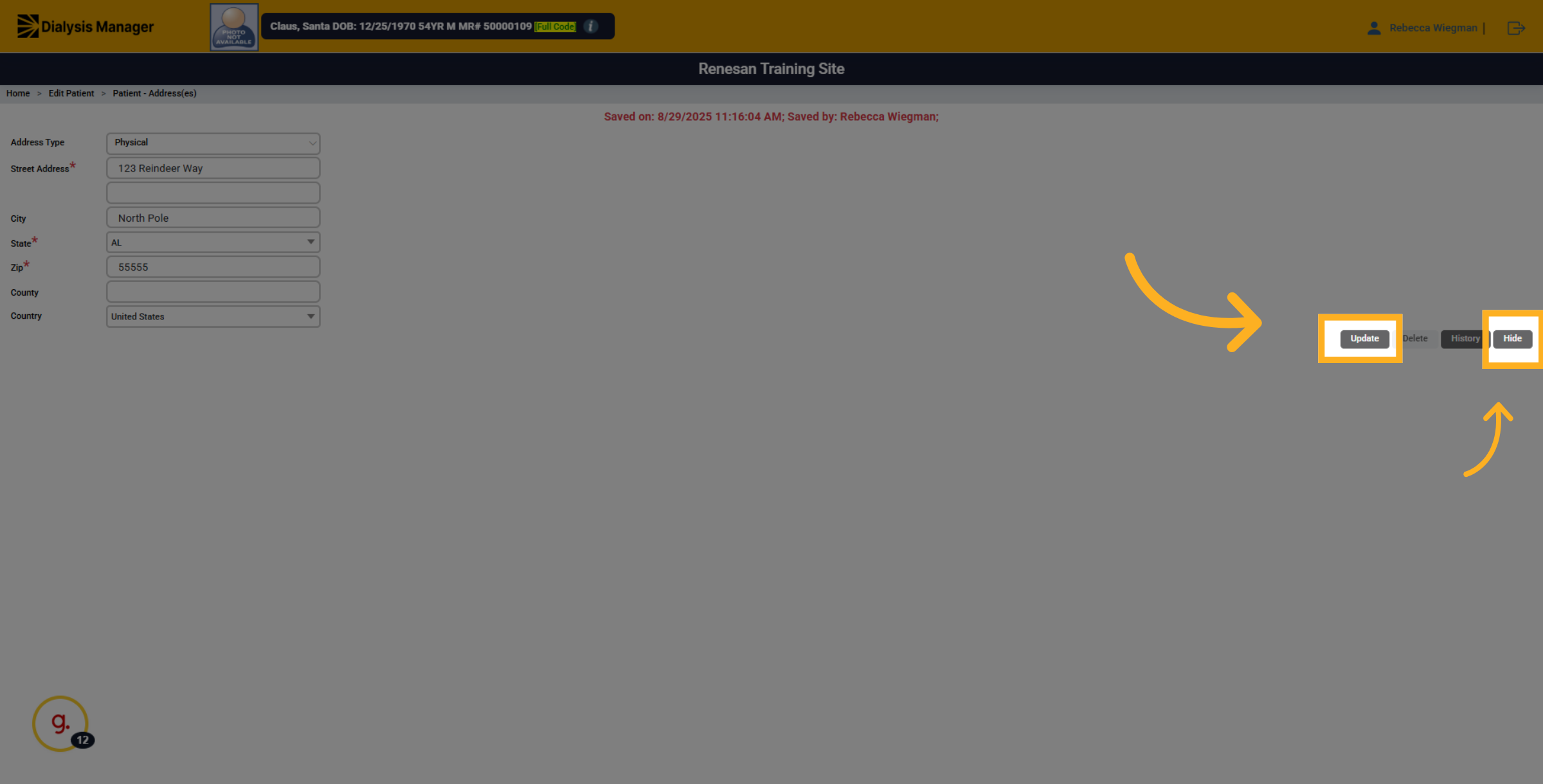 Click 'Hide'